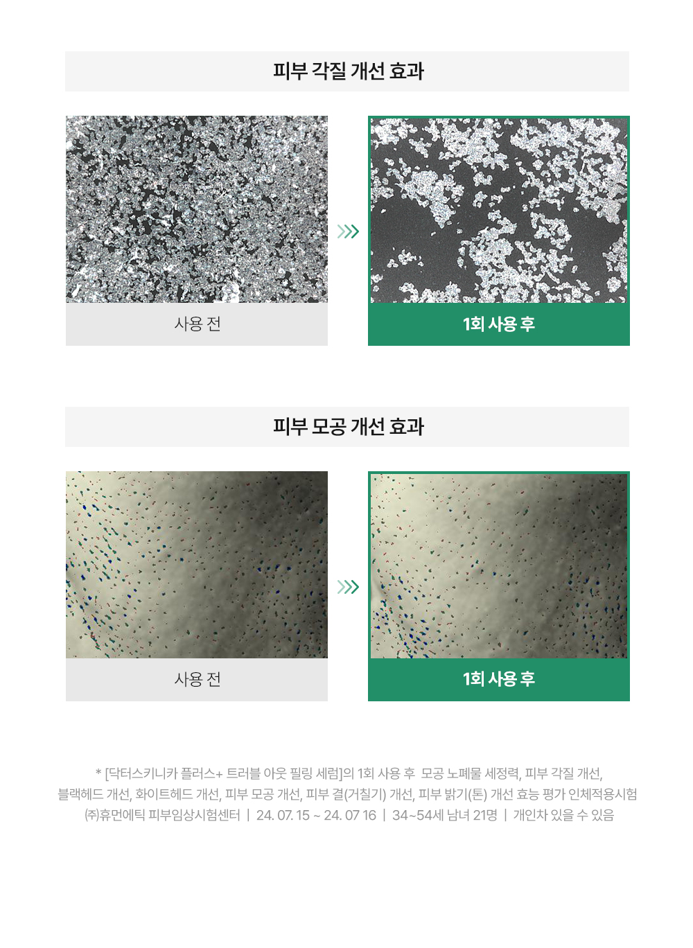 💚자민경x더쿠💚 저자극 5세대 필링 세럼 ‘닥터 스키니카 플러스 트러블 아웃 필링 세럼’ 체험단 모집📢