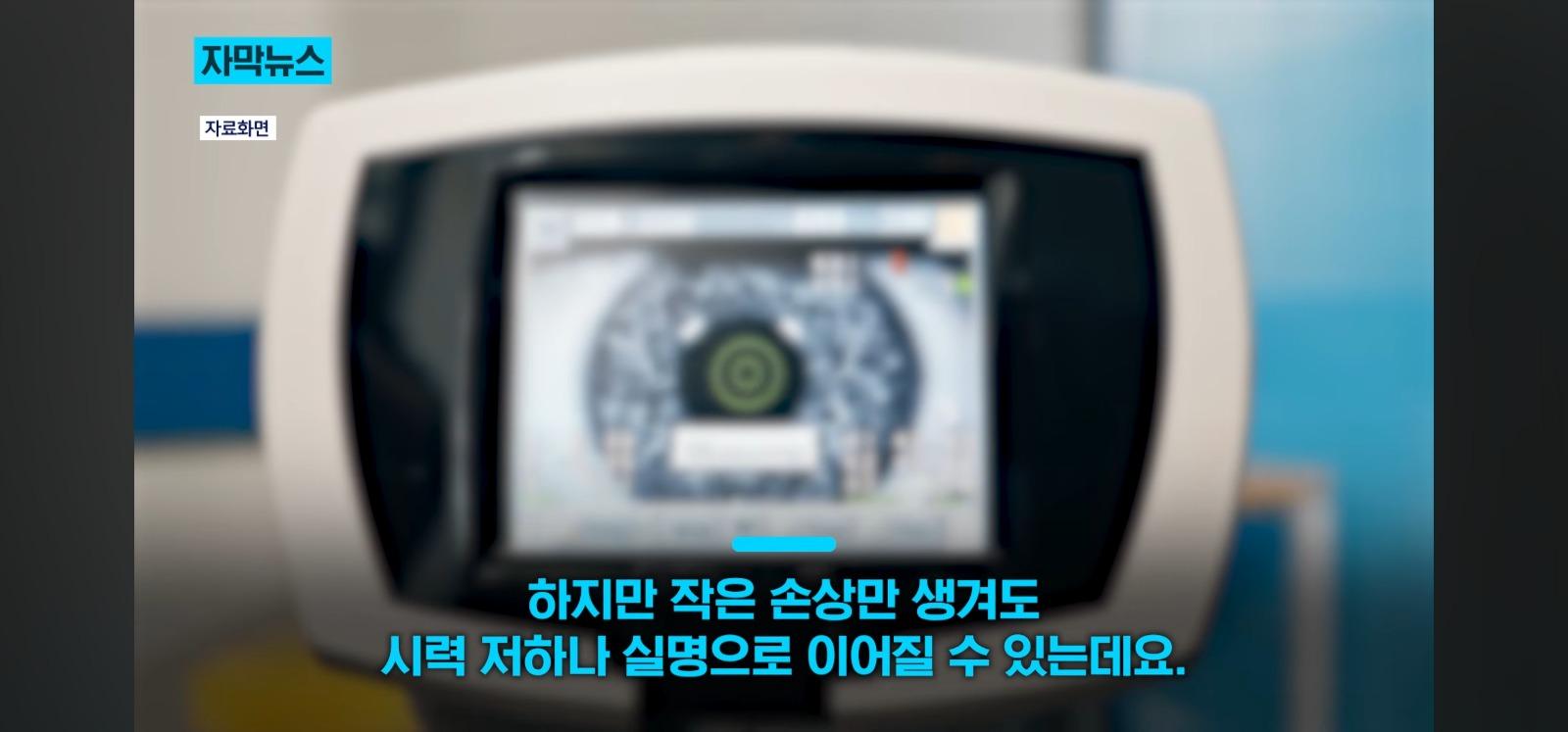살아있는 인공각막 만드는데 성공