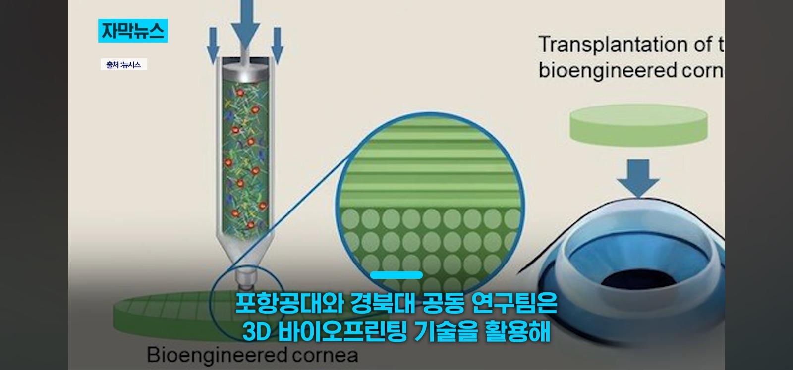 살아있는 인공각막 만드는데 성공