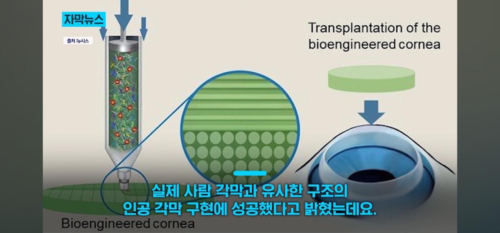 살아있는 인공각막 만드는데 성공