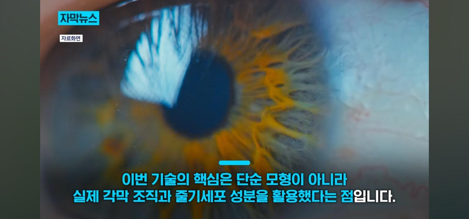 살아있는 인공각막 만드는데 성공