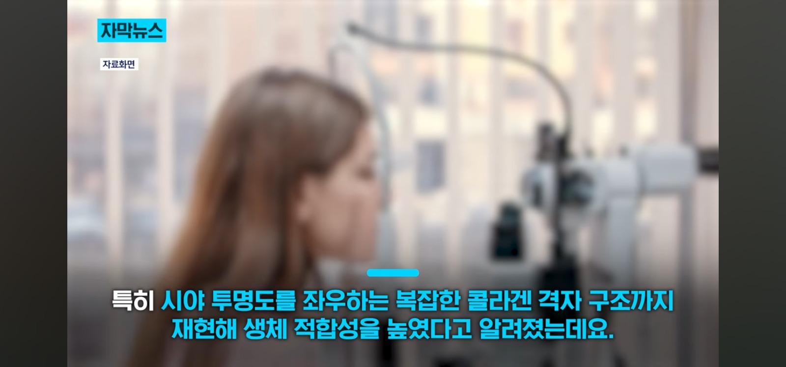 살아있는 인공각막 만드는데 성공