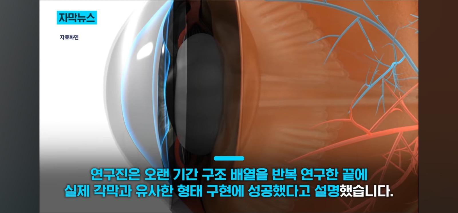 살아있는 인공각막 만드는데 성공