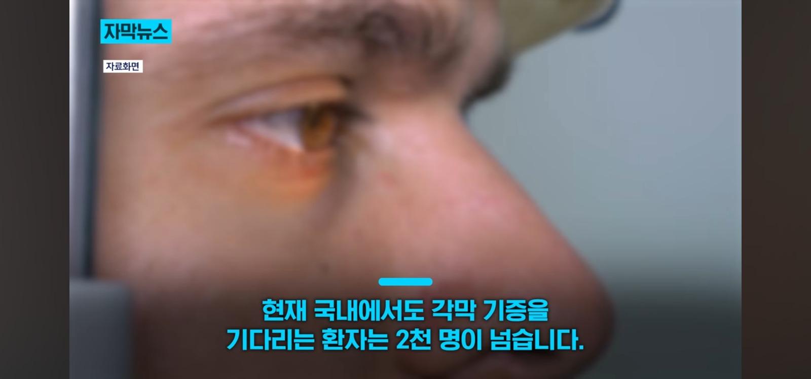살아있는 인공각막 만드는데 성공