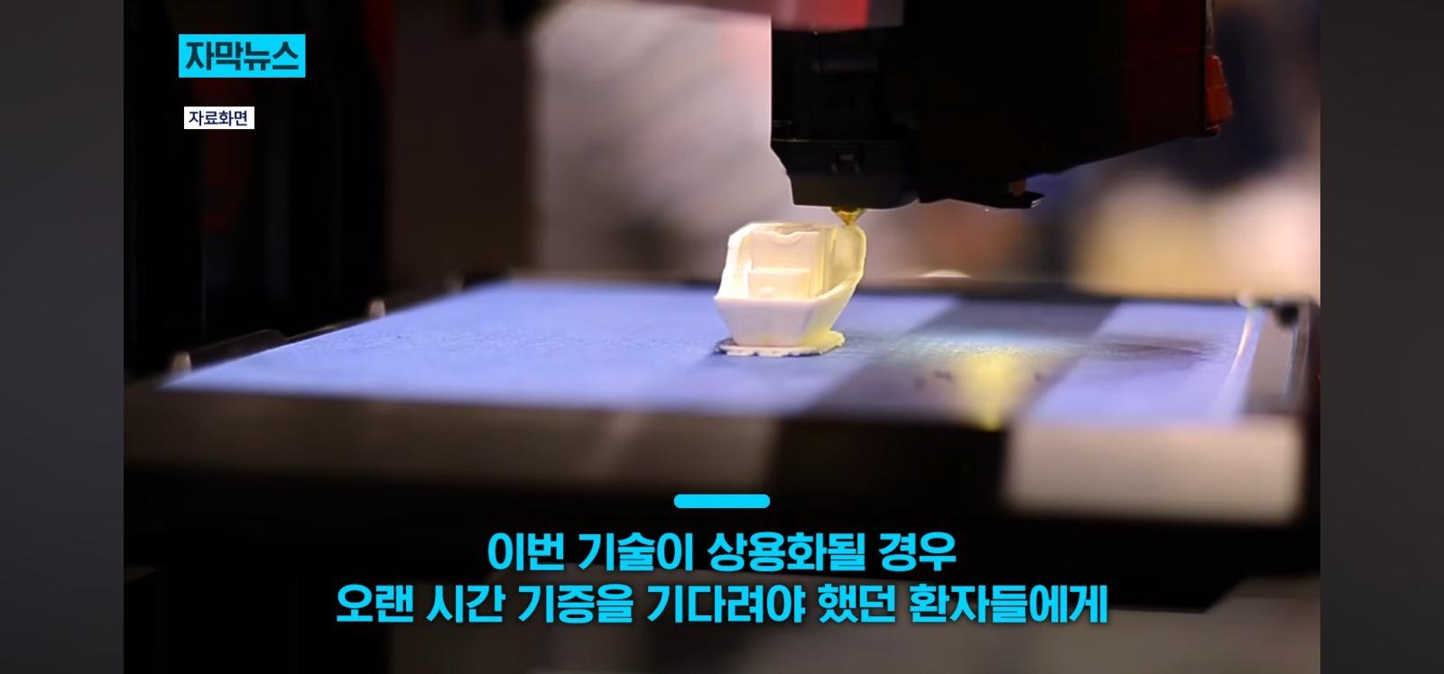 살아있는 인공각막 만드는데 성공