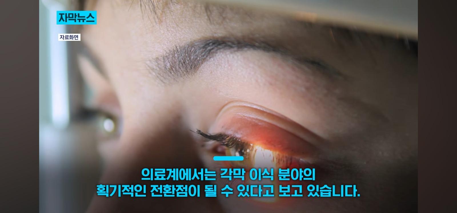 살아있는 인공각막 만드는데 성공