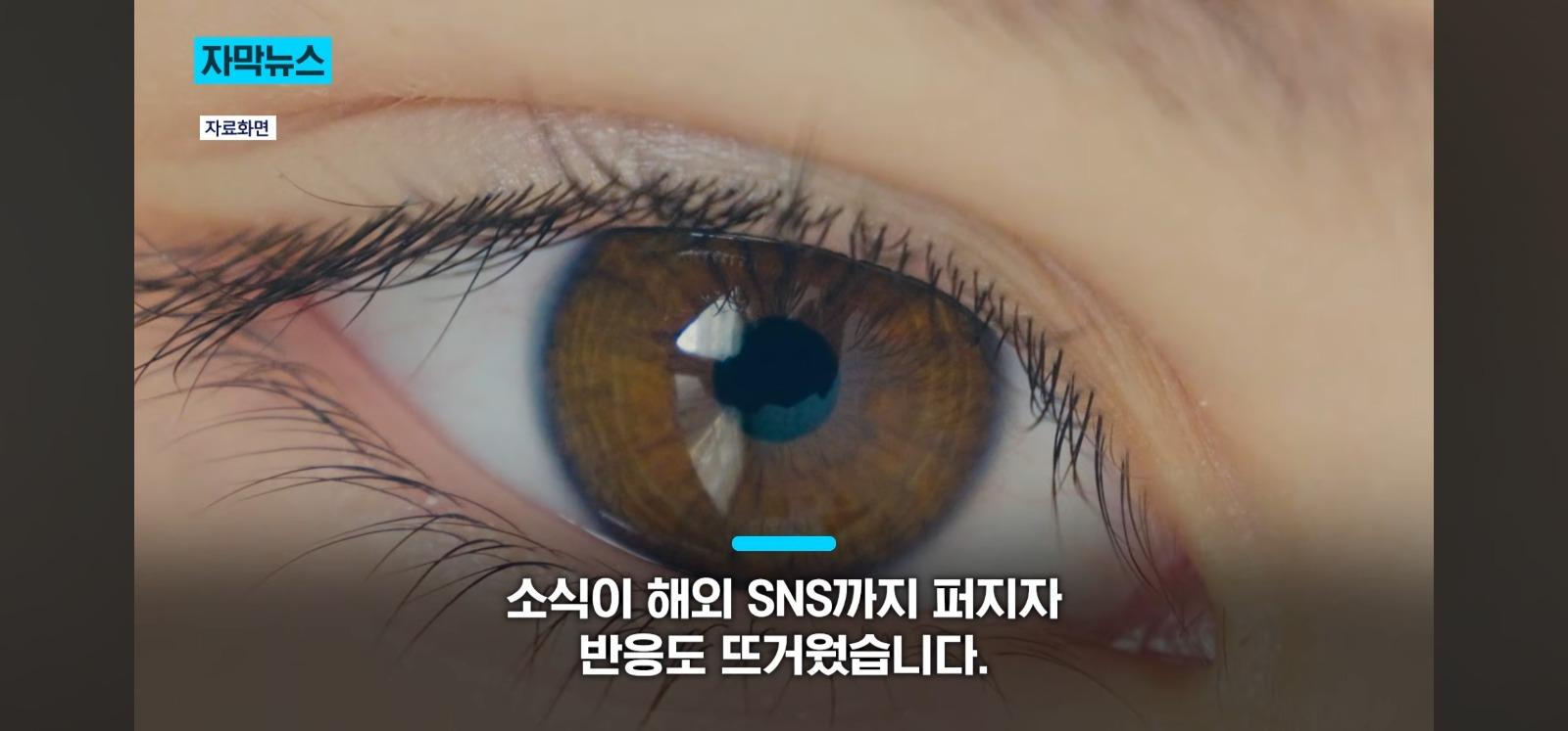 살아있는 인공각막 만드는데 성공