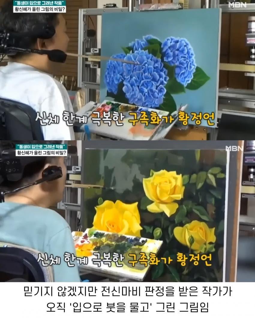 톱스타 누나를 둔 전신마비 동생의 직업