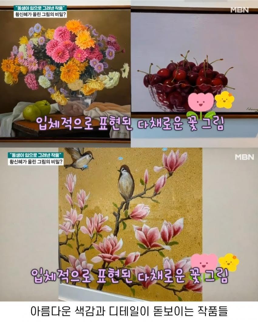 톱스타 누나를 둔 전신마비 동생의 직업
