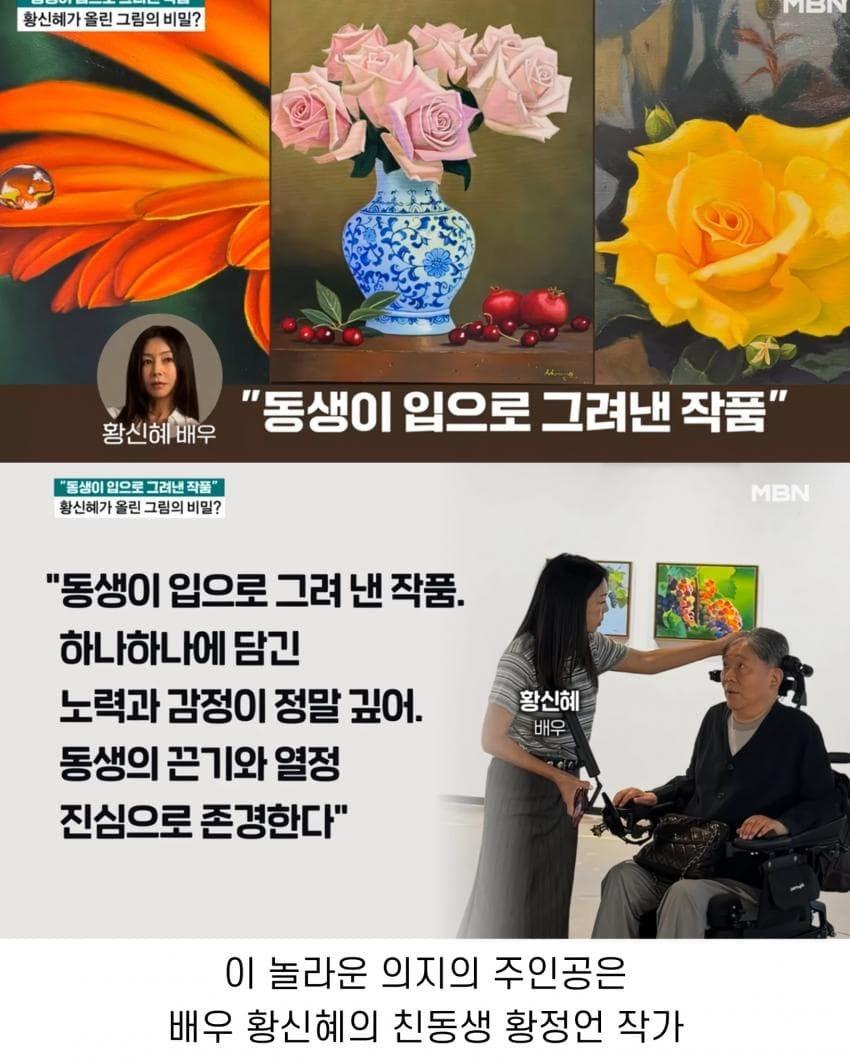 톱스타 누나를 둔 전신마비 동생의 직업