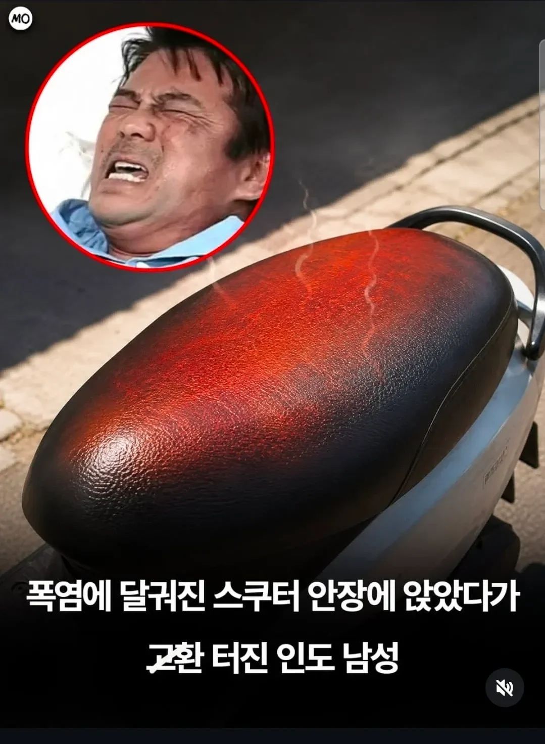 고환이 터져버린 인도 남성