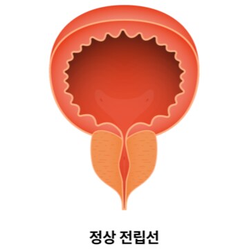왜 일부 사람은 전립선 자극으로 가버릴까?