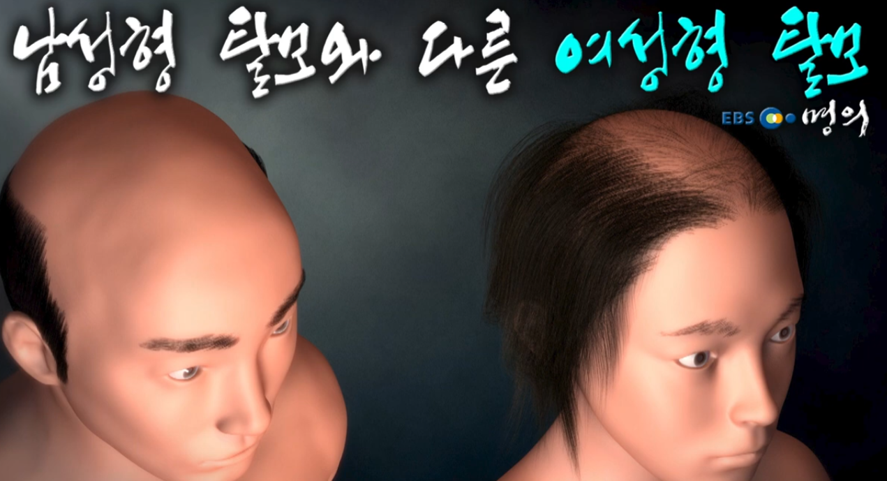 머리숱 줄기 전에 알았으면 좋았을 것들 총정리