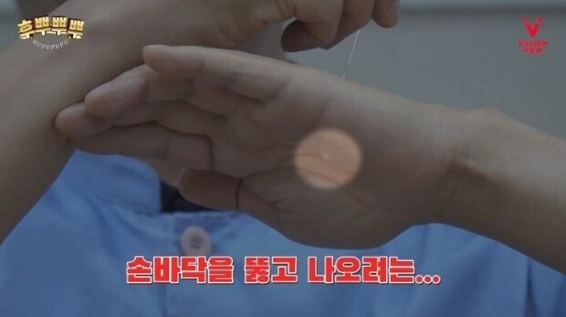 혐) 한의사만 가능한 마술