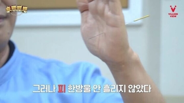 혐) 한의사만 가능한 마술