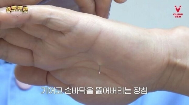 혐) 한의사만 가능한 마술