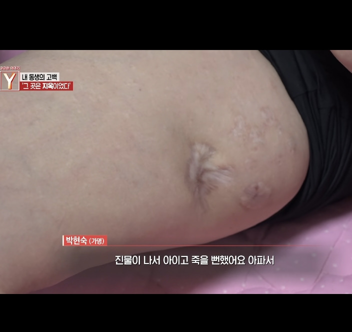 오늘자 30년만에 드러난 개충격적인 사건 (꼭 읽어줘)