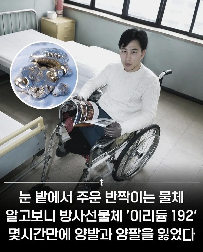 중국] 공사 현장에서 금속 주웠다가 방사능에 피폭된 사람.txt
