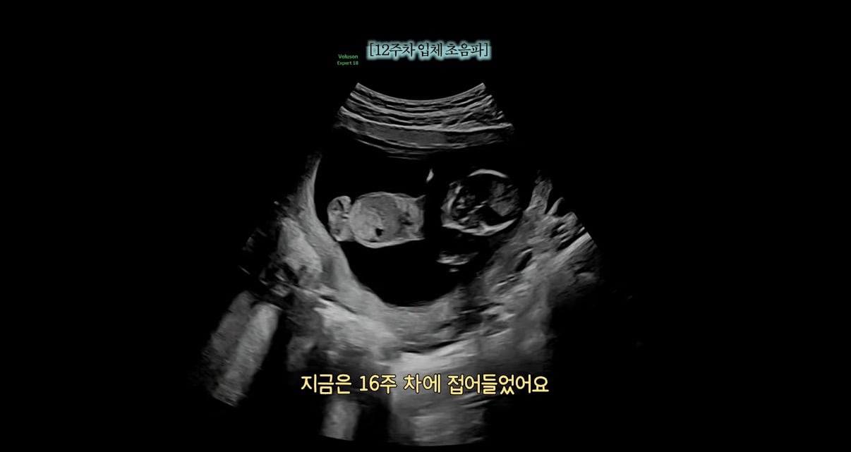 나는솔로 28기 돌싱특집 옥순 영호 둘째 임신