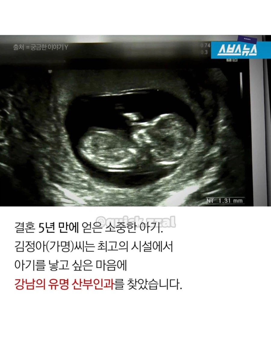 의사 개인 일정 때문에 양수 터진지 10시간 뒤 출산... 태아 사망