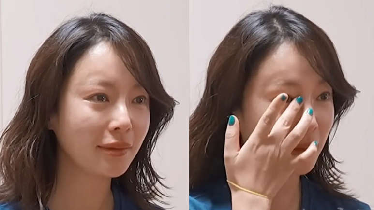 변해버린 황정음 얼굴