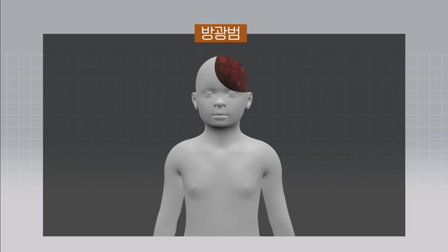 5.18 당시 군인아저씨 보고 반가워서 손 흔들었다가 난사당해 죽은 초등학생