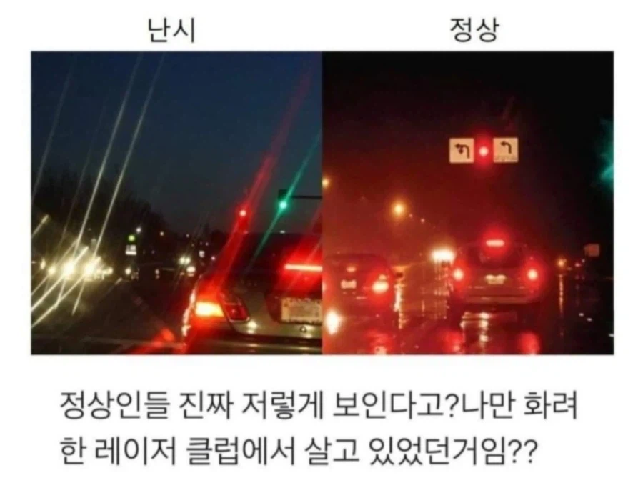 난시가 맞긴 한거같은데