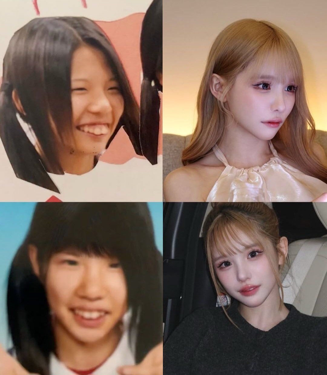 성형 수술에 2억 4천만원 쓰고 과거 사진 공개한 인플루언서