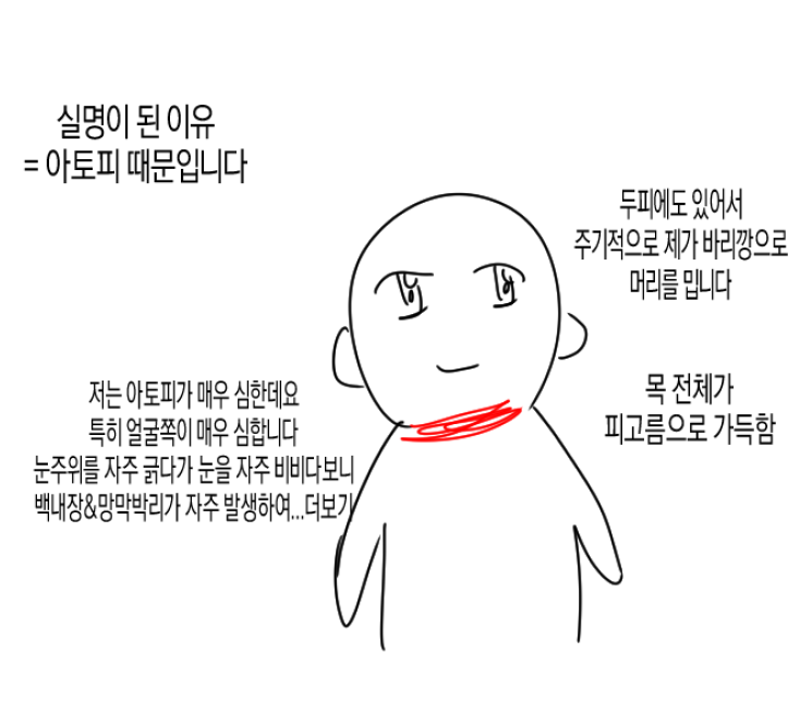 아토피가 정말 힘든 이유…