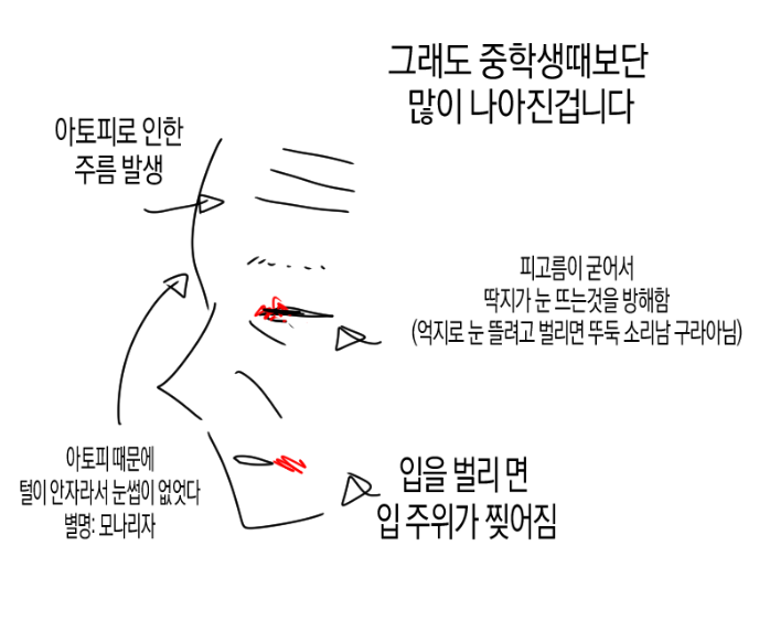 아토피가 정말 힘든 이유…