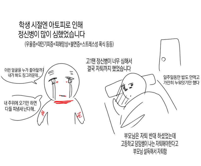 아토피가 정말 힘든 이유…
