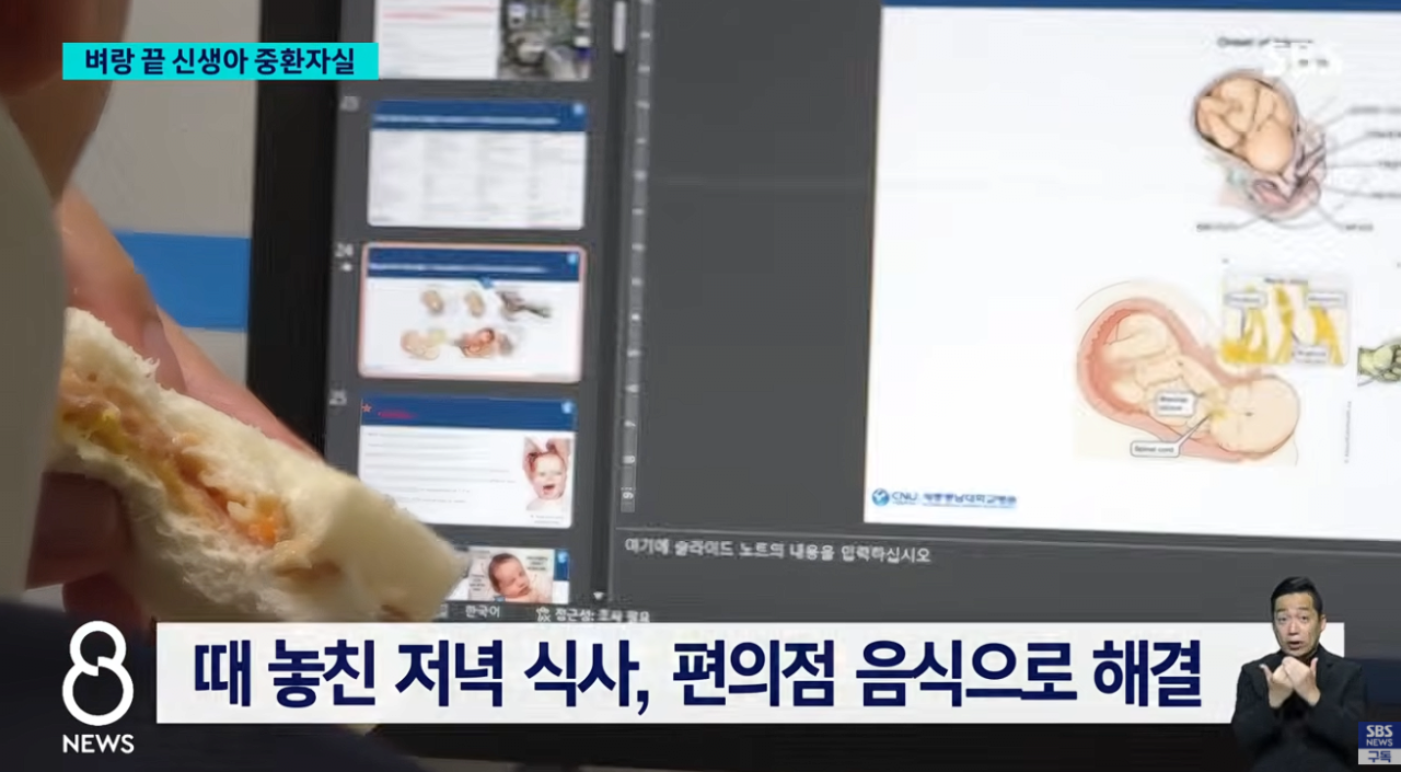 64시간 근무에 24시간 대기 신생아중환자실 전공의가 남긴 말