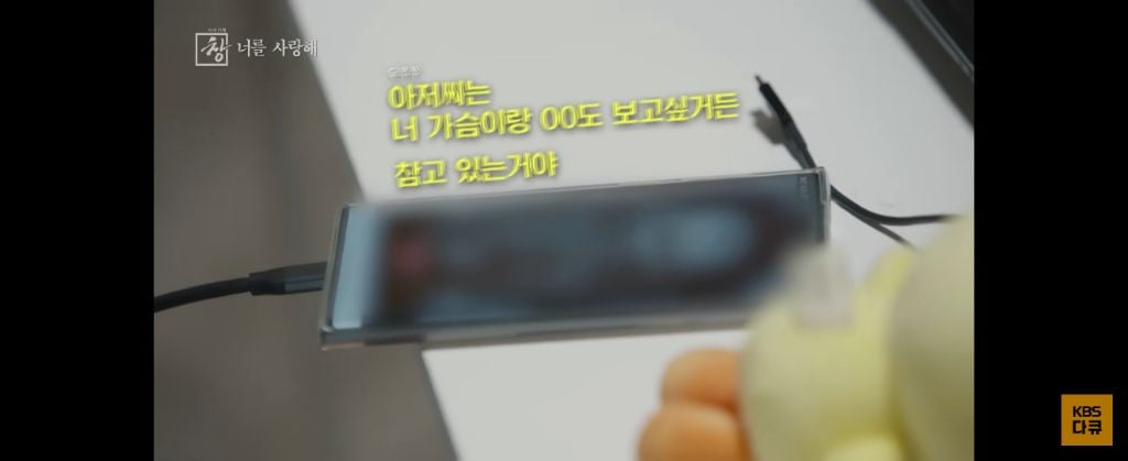 위고비 왜하냐 이거보면 없던 입맛도 떨어지는데