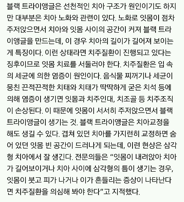 '블랙 트라이앵글' 당신의 치아 노리는 블랙홀