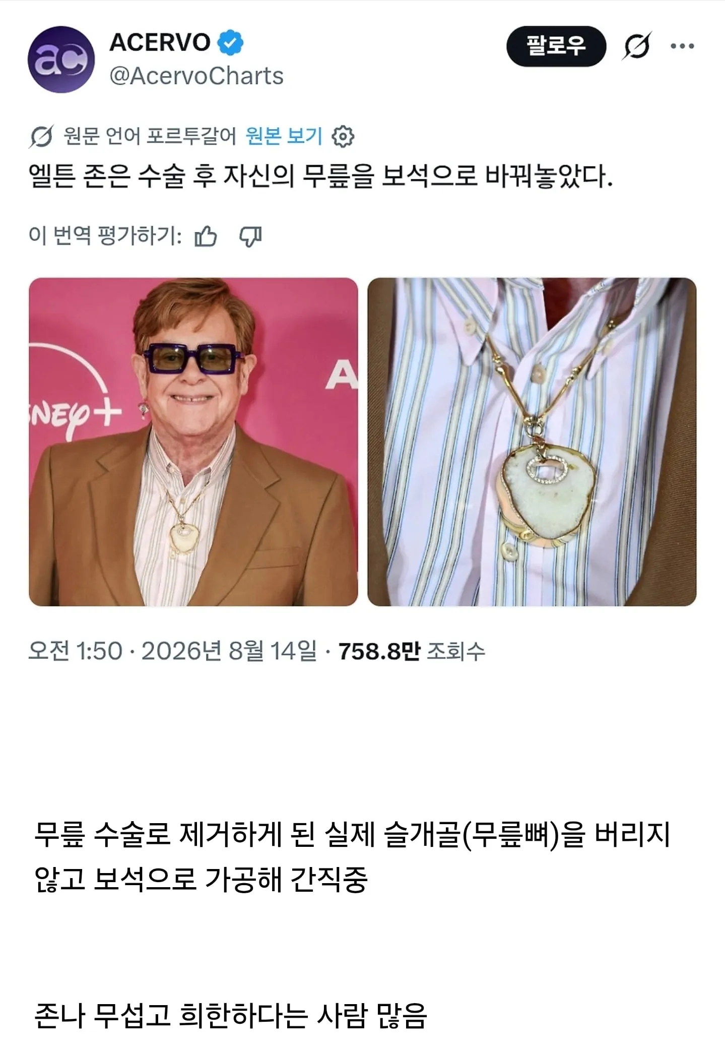 무섭다는 반응 많은 엘튼존 목걸이