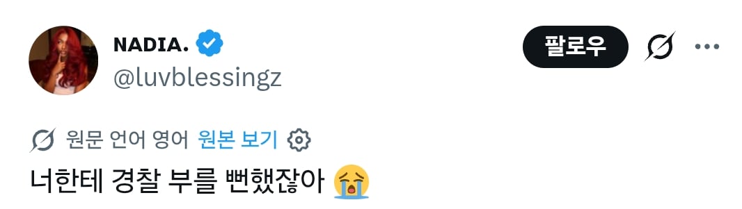 두피 정말 아파보인다고 화제인 사진