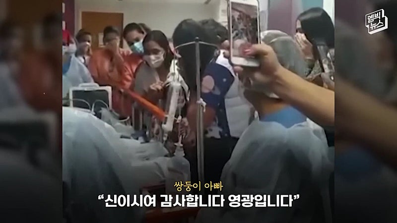33시간 수술 끝에 얼굴 본 쌍둥이