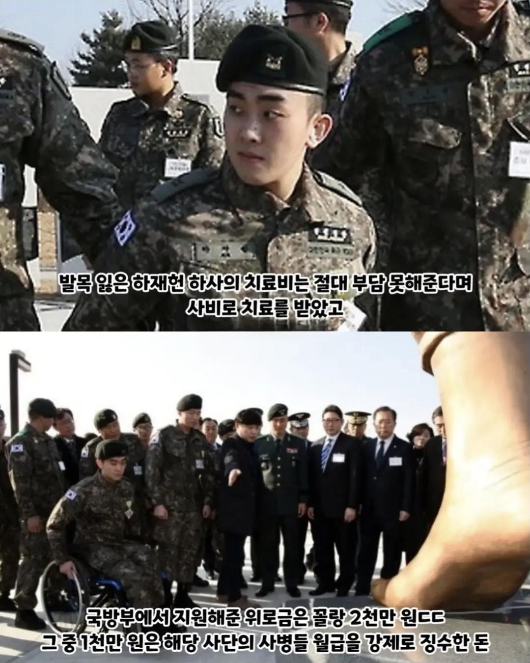 2억짜리  발목 동상