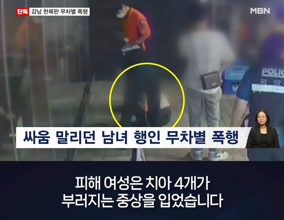 강남 여성 무차별 폭행한 20대 남성..치아 4개 부러져