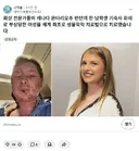 화상 환자 치료 신기술 근황