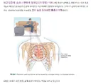 젊은 사람일수록 잘 걸린다는 심장병