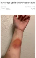 여동생 남친에게 얻어맞은 썰