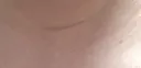 다들 자기 아픈걸로 베글 가는거야?
