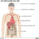 수면 부족이 신체에 미치는 영향