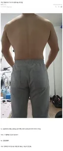 정형외과에 간 헬창