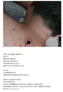 (혐) 옛 시절 사람 많이 죽였다는 등창