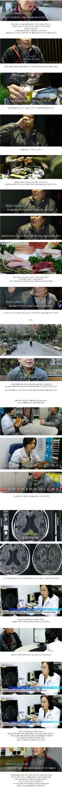 50대 애주가의 뇌 상태