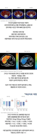 마운자로 1년 맞았더니 내장지방에 생긴 변화.jpg